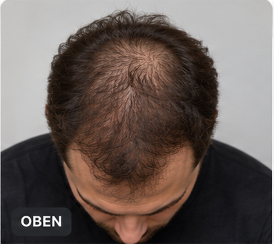 Beispiel für eine geeignete Oberkopfaufnahme der Haare