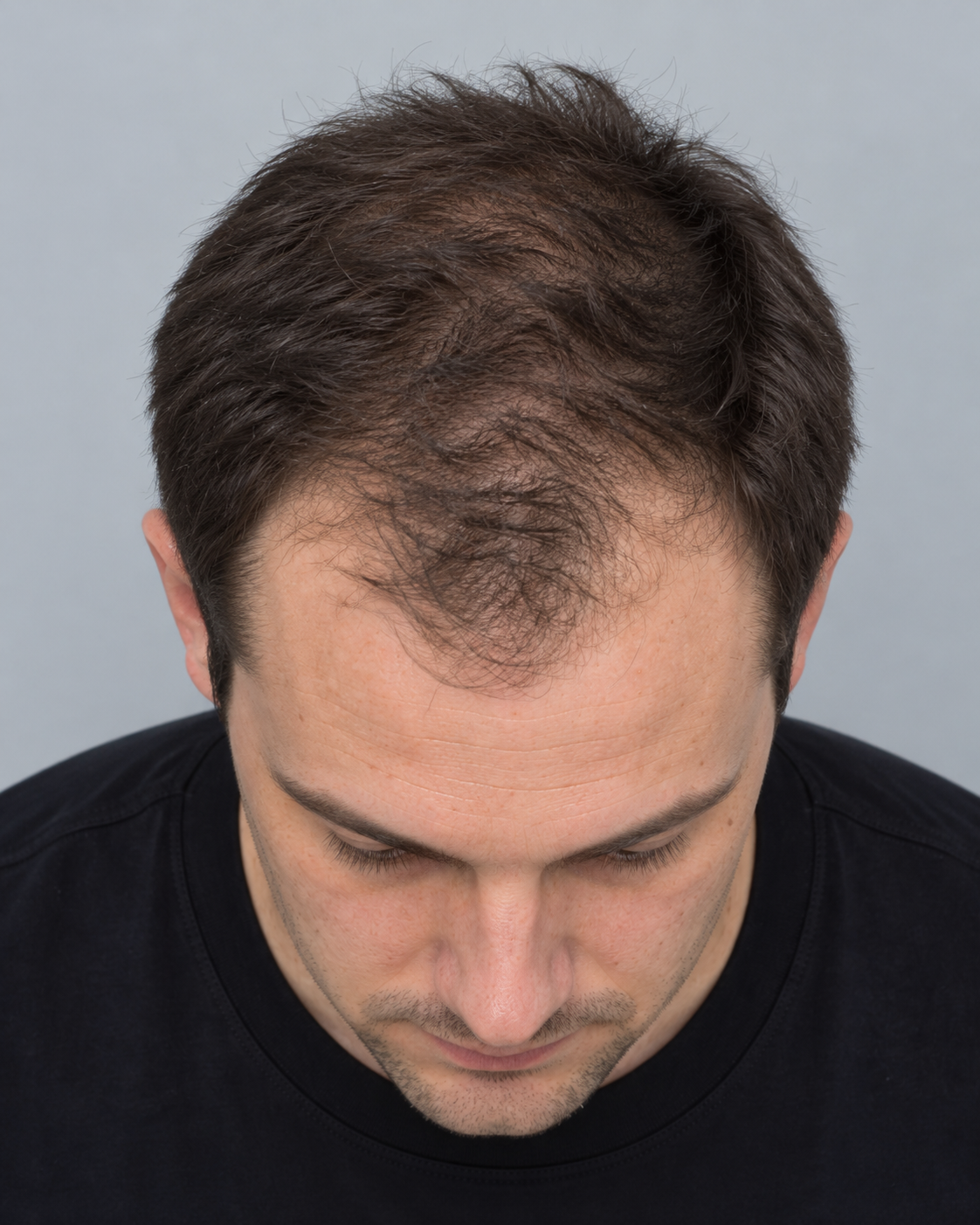 Beispielfoto Oberkopfansicht für eine Haaranalyse